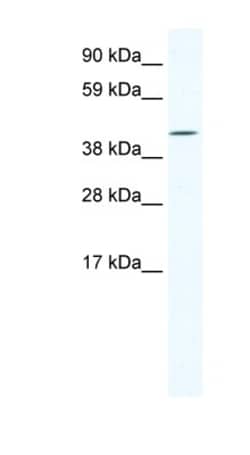 IRX6 Antibody, Novus Biologicals 100&mu;L; Unlabeled:Antibodies, Polyclonal