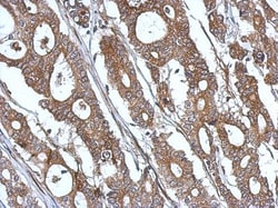 ISG15/UCRP Antibody, Novus Biologicals 0.1mL; Unlabeled:Antibodies, Polyclonal