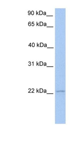 ISG20 Antibody, Novus Biologicals 100&mu;L; Unlabeled:Antibodies, Polyclonal