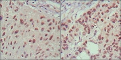 Islet-1 Antibody (1H9), Novus Biologicals 0.1mL; Unlabeled:Antibodies,