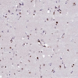 anti-Islet-1, Polyclonal, Novus Biologicals 0.1mL; Unlabeled:Antibodies,