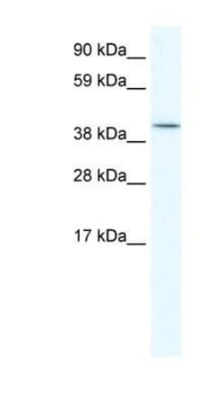 Islet-2 Antibody, Novus Biologicals 20μL; Unlabeled:Antibodies, Polyclonal