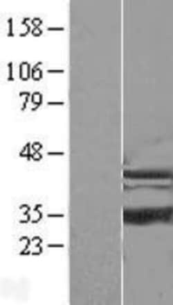 Novus Biologicals&trade;&nbsp;ISOC1 Overexpression Lysate