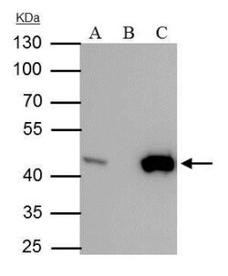 Isocitrate Dehydrogenase 1/IDH1 Antibody (1521), Novus Biologicals 0.1 mL | Buy Online | Novus Biologicals | Fisher Scientific