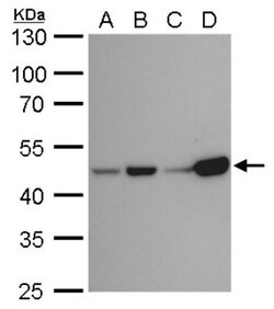 Isocitrate Dehydrogenase 1/IDH1 Antibody (1521), Novus Biologicals 0.1 mL | Buy Online | Novus Biologicals | Fisher Scientific