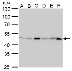 Isocitrate Dehydrogenase 1/IDH1 Antibody (1521), Novus Biologicals 0.1 mL | Buy Online | Novus Biologicals | Fisher Scientific