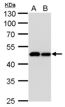 Isocitrate Dehydrogenase 1/IDH1 Antibody (1521), Novus Biologicals 0.1 mL | Buy Online | Novus Biologicals | Fisher Scientific