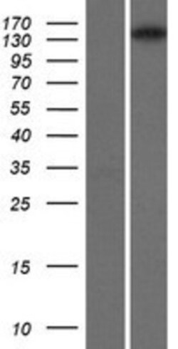 Novus Biologicals&trade;&nbsp;Isoleucyl tRNA synthetase Overexpression Lysate