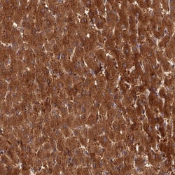 ISPD Antibody, Novus Biologicals 0.1 mL | Buy Online | Novus Biologicals | Fisher Scientific