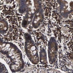ITCH/AIP4 Antibody, Novus Biologicals 0.1mL; Unlabeled:Antibodies, Polyclonal