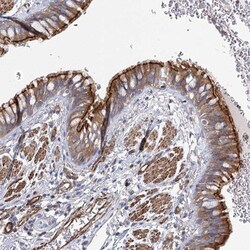 ITF46 Antibody, Novus Biologicals 25 &mu;L; Unlabeled:Antibodies, Polyclonal