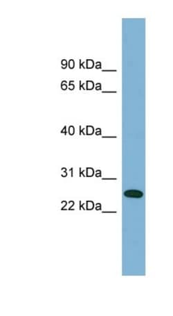 ITGB1BP3 Antibody, Novus Biologicals 20&mu;L; Unlabeled:Antibodies, Polyclonal