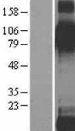 Novus Biologicals&trade;&nbsp;Integrin beta 6 Overexpression Lysate