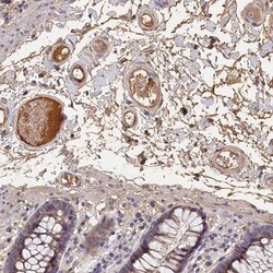 ITIH1 Antibody, Novus Biologicals:Antibodies:Primary Antibodies
