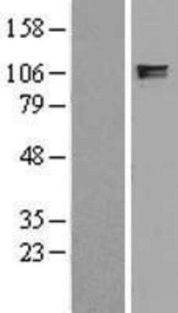 Novus Biologicals&trade;&nbsp;ITIH2 Overexpression Lysate