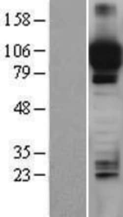 Novus Biologicals™ ITIH4 Overexpression Lysate