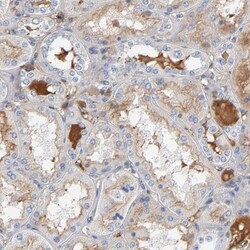 ITIH4 Antibody, Novus Biologicals:Antibodies:Primary Antibodies