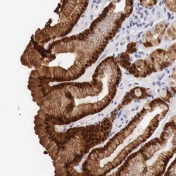 ITIH5L Antibody, Novus Biologicals:Antibodies:Primary Antibodies