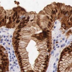 ITIH5L Antibody, Novus Biologicals:Antibodies:Primary Antibodies
