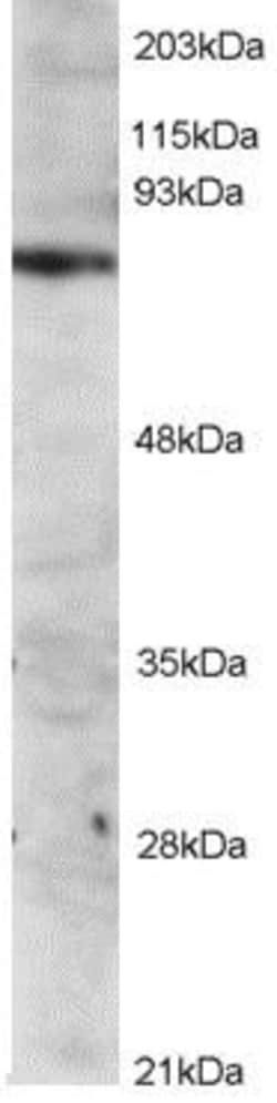 ITK Antibody, Novus Biologicals 0.1mg; Unlabeled:Antibodies, Polyclonal
