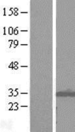 Novus Biologicals&trade;&nbsp;ITM2B Overexpression Lysate