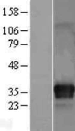 Novus Biologicals&trade;&nbsp;ITM2C Overexpression Lysate