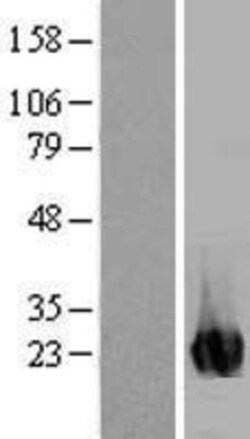 Novus Biologicals&trade;&nbsp;ITPA Overexpression Lysate