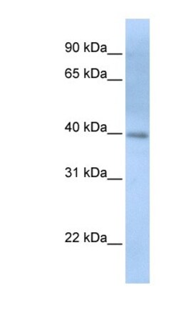 ITPK1 Antibody, Novus Biologicals 100&mu;L; Unlabeled:Antibodies, Polyclonal