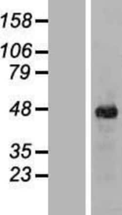 Novus Biologicals&trade;&nbsp;ITPK1 Overexpression Lysate