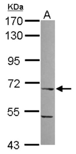 ITPRIPL1 Antibody, Novus Biologicals 0.1mL; Unlabeled:Antibodies, Polyclonal