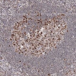 IWS1 Antibody, Novus Biologicals 25 &mu;L | Buy Online | Novus Biologicals | Fisher Scientific