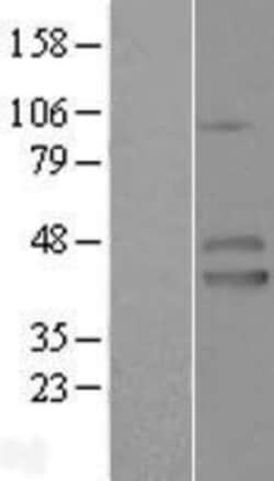Novus Biologicals&trade;&nbsp;IZUMO1 Overexpression Lysate