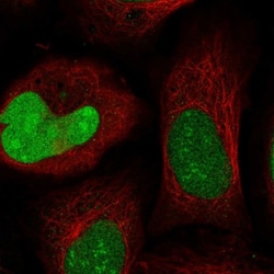 IZUMO2 Antibody, Novus Biologicals 0.1mL; Unlabeled:Antibodies, Polyclonal