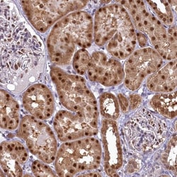 IZUMO2 Antibody, Novus Biologicals 0.1mL; Unlabeled:Antibodies, Polyclonal