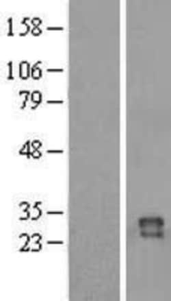 Novus Biologicals&trade;&nbsp;IZUMO4 Overexpression Lysate