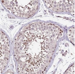 IZUMO4 Antibody, Novus Biologicals 25 &mu;L, Unlabeled:Antibodies, Polyclonal