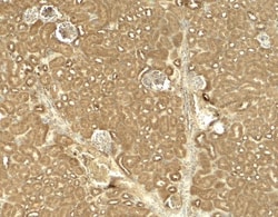 Jak2 Antibody - BSA Free, Novus Biologicals:Antibodies:Primary Antibodies