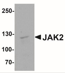 Jak2 Antibody - BSA Free, Novus Biologicals:Antibodies:Primary Antibodies