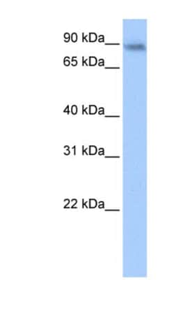 JAKMIP1 Antibody, Novus Biologicals 100&mu;L; Unlabeled:Antibodies, Polyclonal