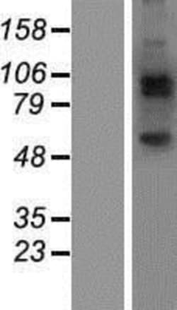 Novus Biologicals™ JAKMIP2 Overexpression Lysate