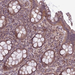 AMICA/JAML Antibody, Novus Biologicals:Antibodies:Primary Antibodies