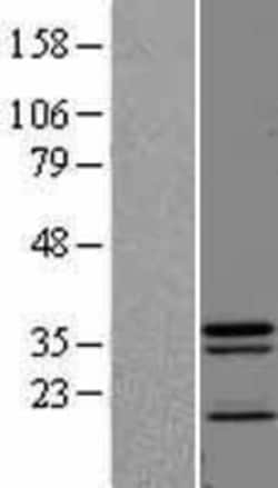 Novus Biologicals&trade;&nbsp;JAMP Overexpression Lysate