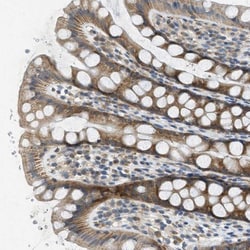 JCAD Antibody, Novus Biologicals:Antibodies:Primary Antibodies
