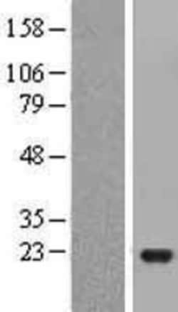 Novus Biologicals&trade;&nbsp;JDP2 Overexpression Lysate