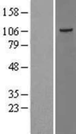 Novus Biologicals&trade;&nbsp;JIK Overexpression Lysate