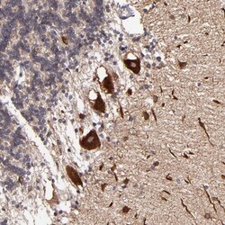 JM4 Antibody, Novus Biologicals:Antibodies:Primary Antibodies