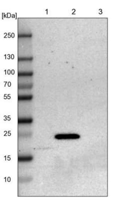 JM4 Antibody, Novus Biologicals:Antibodies:Primary Antibodies