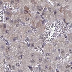 JMJD1C Antibody, Novus Biologicals 25 &mu;L | Buy Online | Novus Biologicals | Fisher Scientific