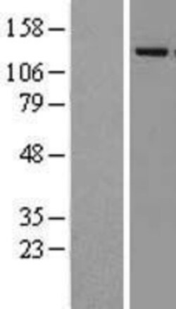 Novus Biologicals&trade;&nbsp;Lysine (K)-specific Demethylase 4A/KDM4A/JMJD2A Overexpression Lysate