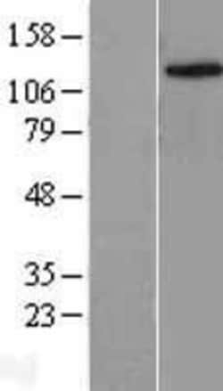 Novus Biologicals&trade;&nbsp;Lysine (K)-specific Demethylase 4C/KDM4C/JMJD2C Overexpression Lysate